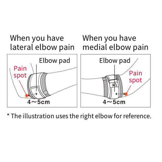 Elbow Band
